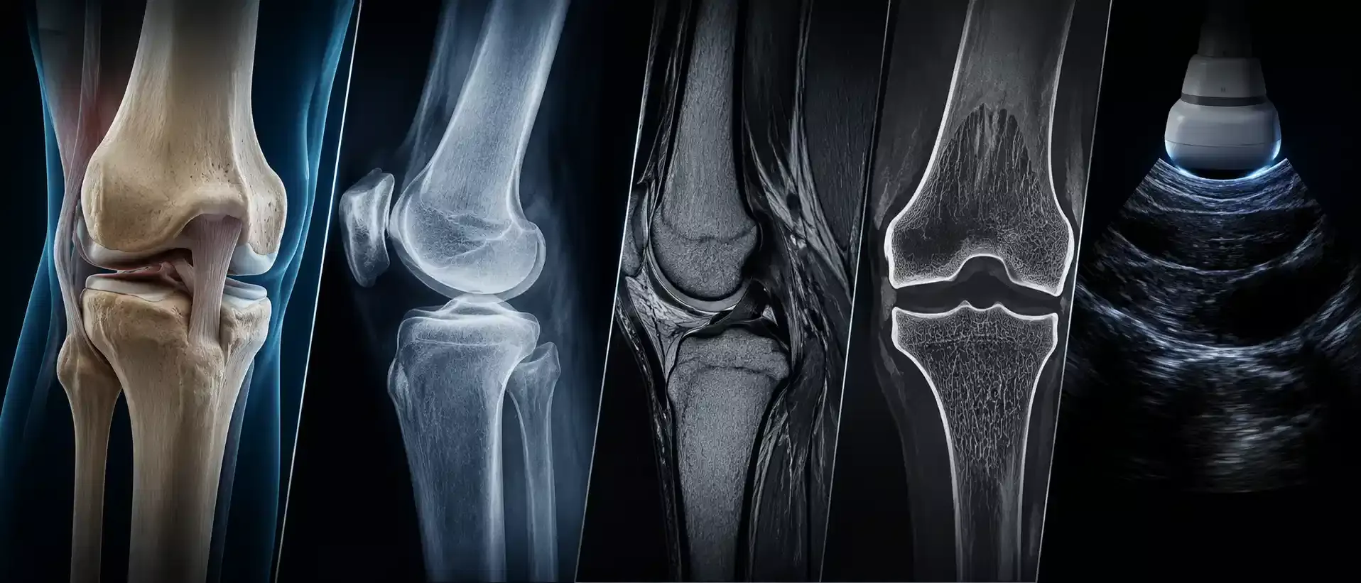 MRI, CT, Ultrasound and X-ray Comparison